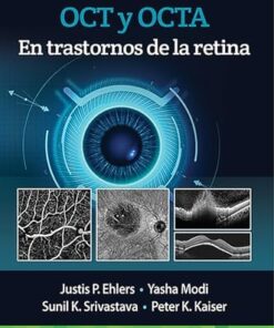 OCT y OCTA en trastornos de la retina (Spanish Edition) (PDF)