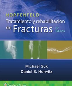 Hoppenfeld. Tratamiento y rehabilitación de fracturas, 2a edición (PDF)