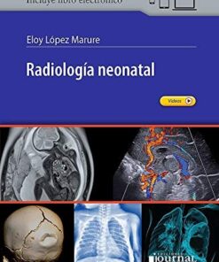 Radiología Neonatal (Scanned PDF)