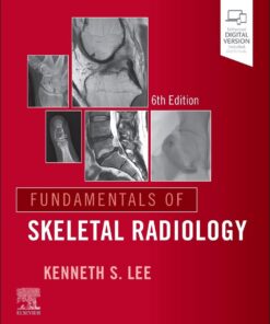 Fundamentals of Skeletal Radiology, 6th Edition (PDF)