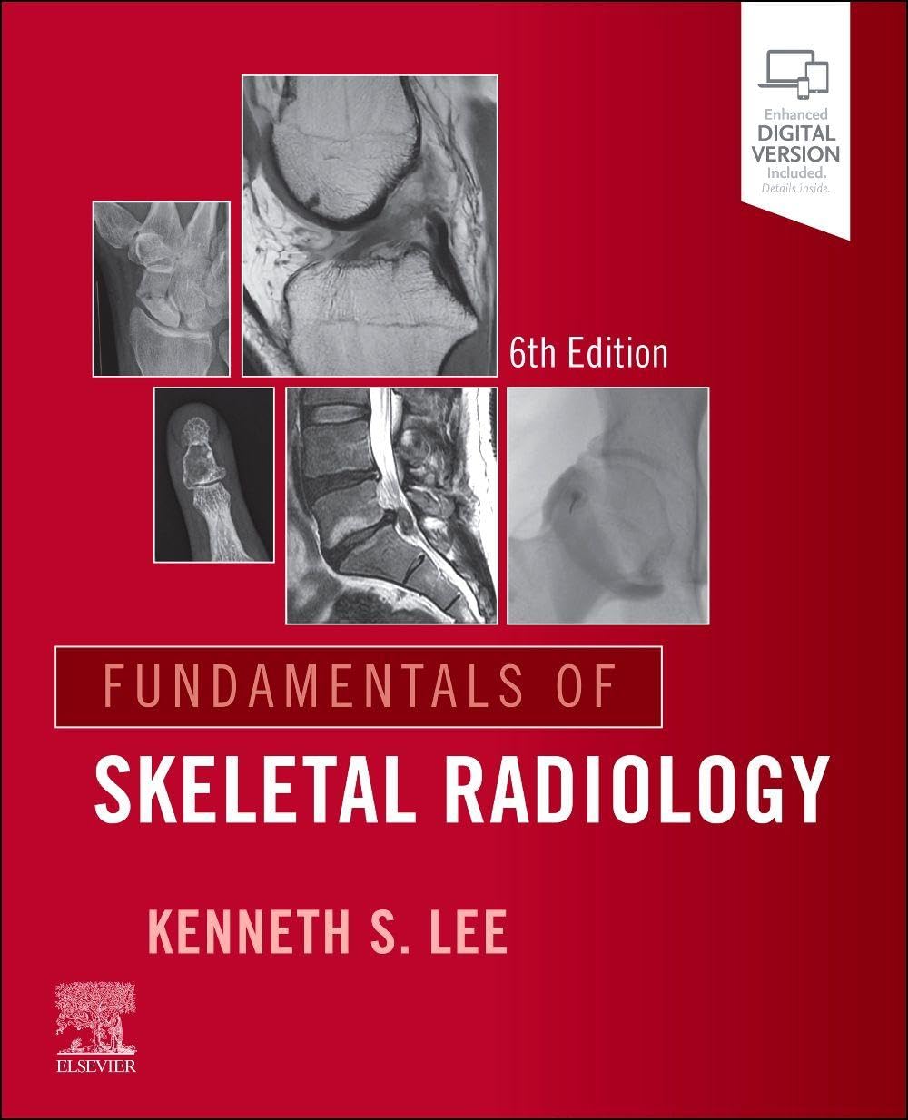Fundamentals of Skeletal Radiology, 6th Edition (PDF)