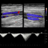 Meetings By Mail Penn Radiology Breast Imaging Immersion Vol.2 2026