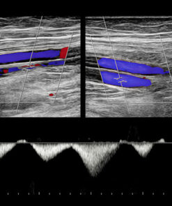 Oakstone Clinical Approach to Vascular Ultrasound and RPVI Prep Course 2026