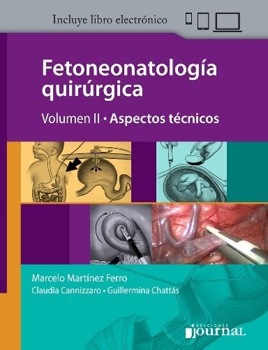 Fetoneonatología quirúrgica. Volumen 2. Aspectos técnicos (Scanned PDF) Fetoneonatología quirúrgica. Volumen 2. Aspectos técnicos (Scanned PDF)