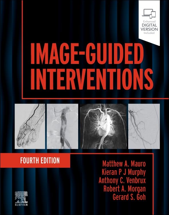 Image-Guided Interventions (Expert Radiology), 4th edition (EPUB) Image-Guided Interventions (Expert Radiology), 4th edition (EPUB)