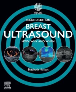 Breast Ultrasound: How, Why and When, 2nd edition (EPUB)