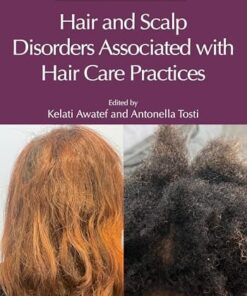 Hair and Scalp Disorders Associated with Hair Care Practices (PDF)