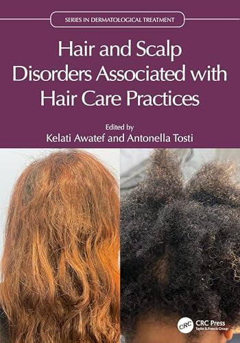 Hair and Scalp Disorders Associated with Hair Care Practices (PDF)