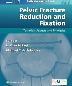 Pelvic Fracture Reduction and Fixation: Technical Aspects and Principles (EPUB)