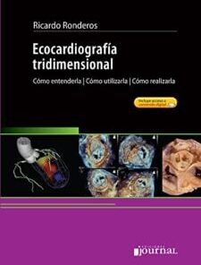 Ecocardiografía tridimensional. Cómo entenderla, Cómo utilizarla, Cómo realizarla (PDF)
