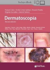 Dermatoscopia, 3a edición (PDF)
