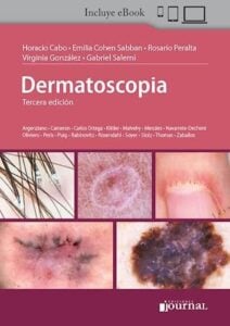 Dermatoscopia, 3a edición (PDF) Dermatoscopia, 3a edición (PDF)