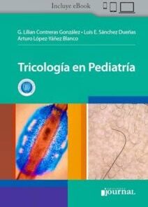 Tricología en Pediatría (PDF)