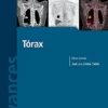 Avances En Diagnostico Por Imágenes Nº 8: Retroperitoneo Y Páncreas (PDF)