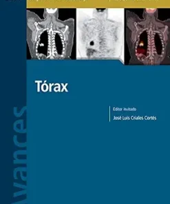 Avances en Diagnóstico por Imágenes: Tórax (Spanish Edition) (PDF)