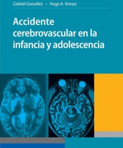 Accidente cerebrovascular en la infancia y adolescencia (Spanish Edition) (PDF)