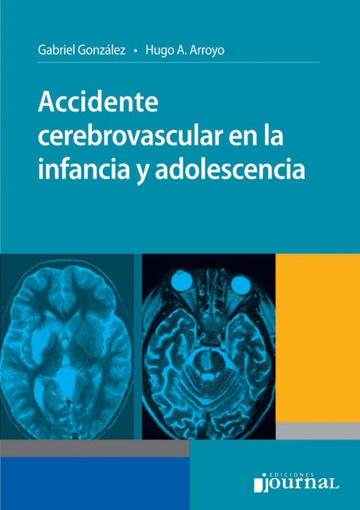Accidente cerebrovascular en la infancia y adolescencia (Spanish Edition) (PDF) Accidente cerebrovascular en la infancia y adolescencia (Spanish Edition) (PDF)
