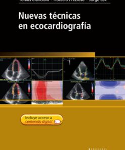 Nuevas tecnicas en Ecocardiografia (Spanish Edition) (PDF)