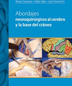 Abordajes neuroquirurgicos al cerebro y la base del craneo (Spanish Edition) (PDF)