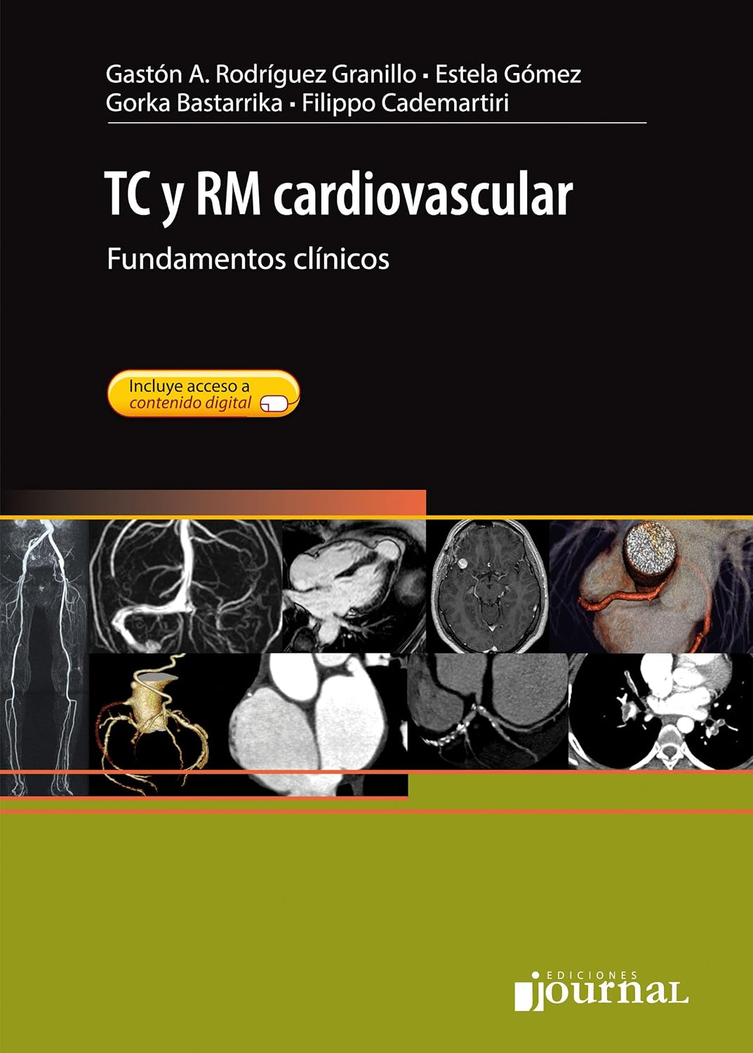 TC y RM cardiovascular (Spanish Edition) (PDF) TC y RM cardiovascular (Spanish Edition) (PDF)