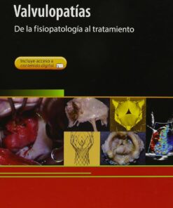 Valvulopatías. De la fisiopatología al tratamiento (Spanish Edition) (PDF)
