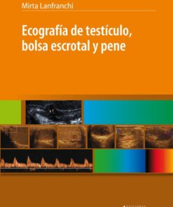 Ecografía de Testículo, Bolsa Escrotal y Pene (PDF)
