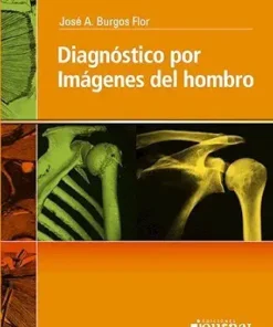 Diagnostico Por Imágenes Del Hombro (PDF)