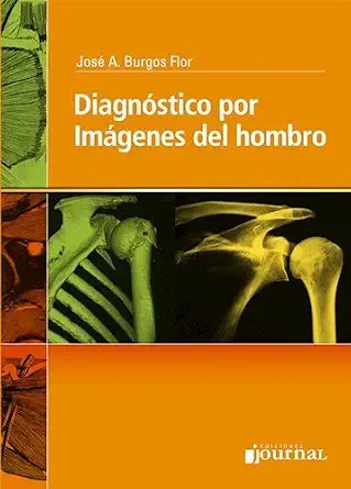 Diagnostico Por Imágenes Del Hombro (PDF) Diagnostico Por Imágenes Del Hombro (PDF)