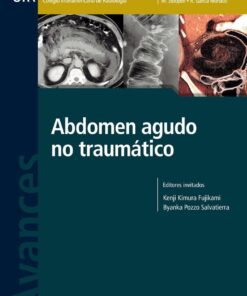 Diabetes Mellitus en niños y adolescentes (Spanish Edition) (PDF)