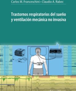 Trastornos respiratorios del sueño y ventilación mecánica no invasiva (PDF)