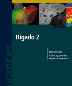 Avances en Diagnóstico por Imágenes: Hígado 2 (PDF)