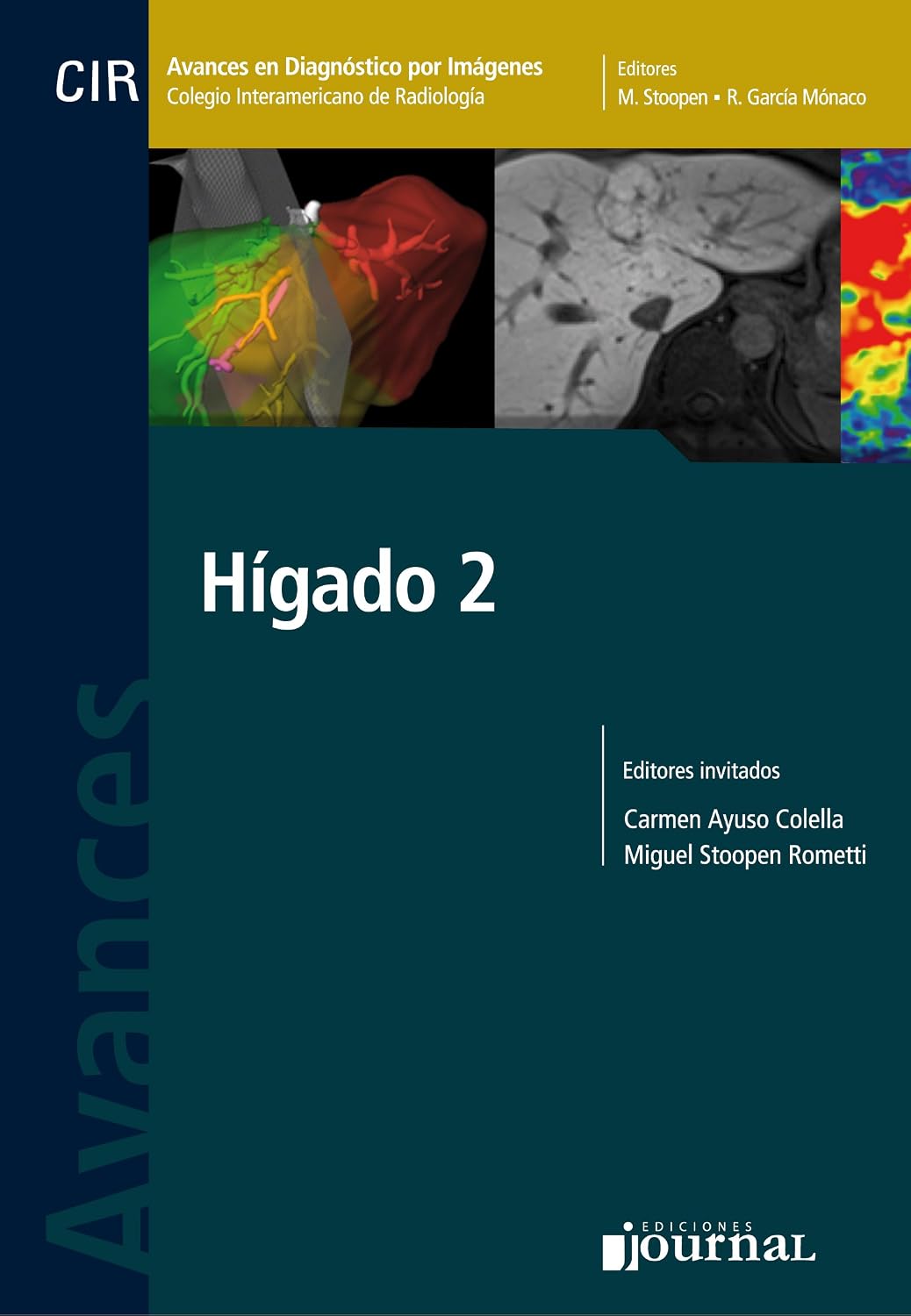 Avances en Diagnóstico por Imágenes: Hígado 2 (PDF) Avances en Diagnóstico por Imágenes: Hígado 2 (PDF)