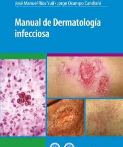 Manual de dermatología infecciosa (PDF)