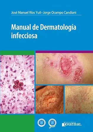 Manual de dermatología infecciosa (PDF) Manual de dermatología infecciosa (PDF)