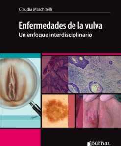 Enfermedades de la vulva- un enfoque interdisciplinario (PDF)