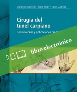 Cirugía Del Tunel Carpiano. Controversias Y Aplicaciones Prácticas (PDF)