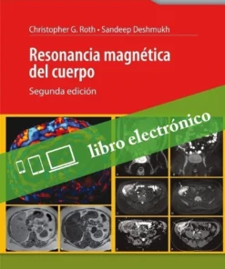 Resonancia Magnetica Del Cuerpo, 2nd Edition (PDF)