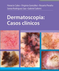 Dermatoscopia: Casos clínicos (Spanish Edition) (PDF)