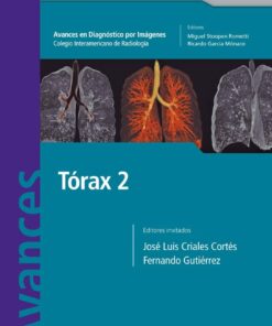 Avances en Diagnóstico por Imágenes: Tórax 2 (Spanish Edition) (PDF)