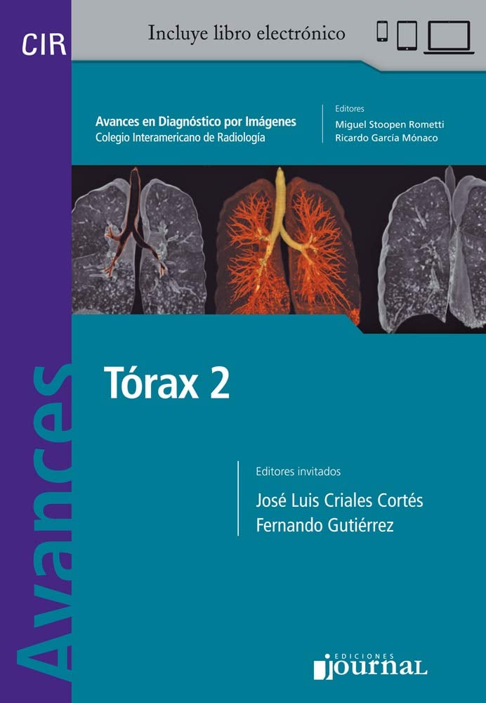 Avances en Diagnóstico por Imágenes: Tórax 2 (Spanish Edition) (PDF) Avances en Diagnóstico por Imágenes: Tórax 2 (Spanish Edition) (PDF)
