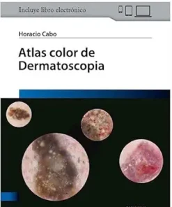 Atlas Color de Dermatoscopia (PDF)