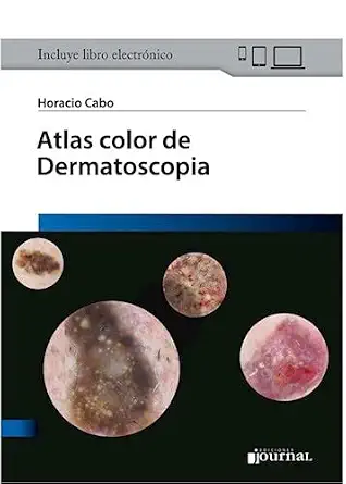 Atlas Color de Dermatoscopia (PDF) Atlas Color de Dermatoscopia (PDF)