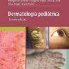 Dermatología en VIH/SIDA (PDF)