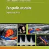 Fundamentos de TC de alta resolución pulmonar, 2nd Edition (PDF)
