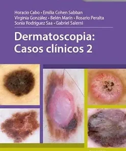 Dermatoscopia: Casos clínicos 2 (PDF)