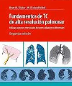Fundamentos de TC de alta resolución pulmonar, 2nd Edition (PDF)
