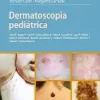 Dermatoscopia, 2nd Edition (PDF) Dermatoscopia, 2nd Edition (PDF)