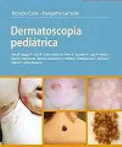 Dermatoscopia Pediátrica (PDF)