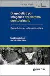 Diagnóstico por Imágenes del Sistema Genitourinario. Casos de Interés en la Práctica Diaria (PDF) Diagnóstico por Imágenes del Sistema Genitourinario. Casos de Interés en la Práctica Diaria (PDF)