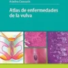 Atlas Color de Dermatoscopia (PDF) Atlas Color de Dermatoscopia (PDF)